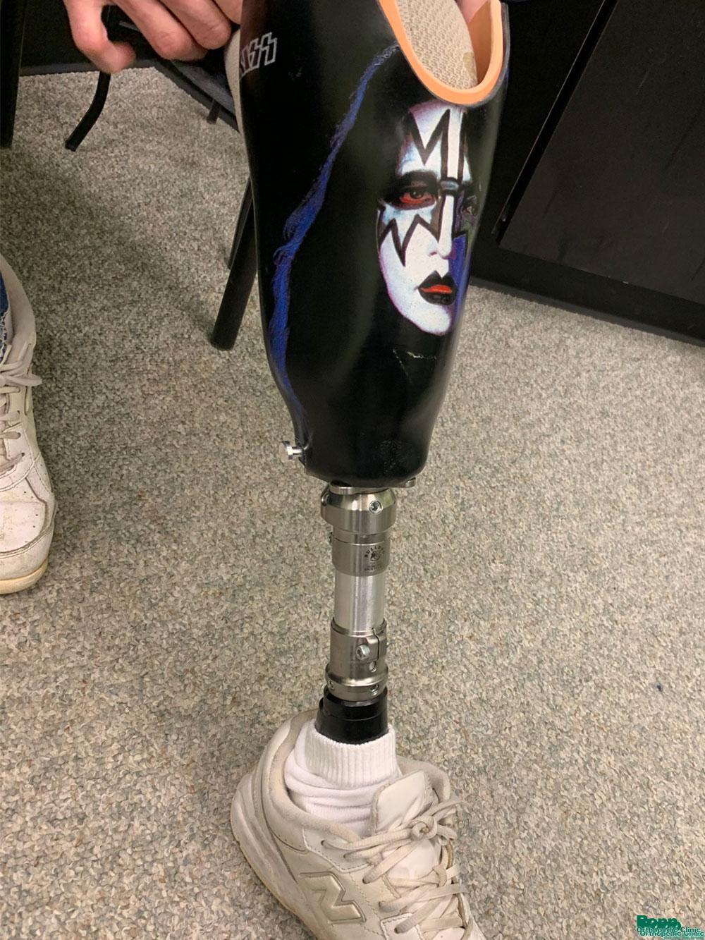 Ace Frehley gracing the prosthesis for our KISS fan.